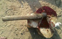 В Башкирии пьяный отец ударил 2-летнюю дочь топором по голове