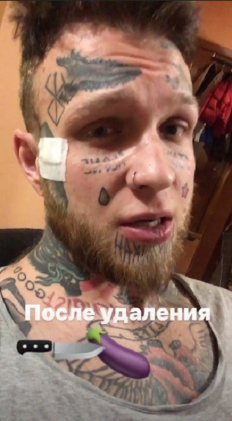 "Никакого секса": сын Яковлевой "отрезал" орган и показал кровавые фото