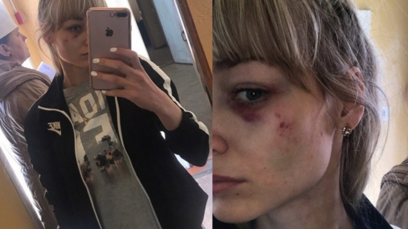 Экс-участник "Дома-2" жестоко избил жену и опубликовал ее секс-видео