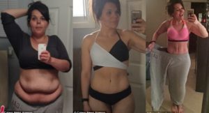 Женщина с ожирением сбросила половину своего веса после расставания с мужем