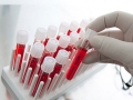 Как правильно сдавать анализ крови на гормоны?