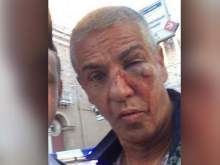 Подозреваемый в избиении звезды «Такси» Сами Насери рассказал об инциденте