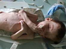 "Просил хлебушка и водички": на Украине нашли 4-летнего ребенка весом 7 кг