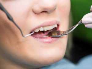 Удаление зубов на дому: просто, быстро, качественно