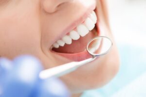 Прием у стоматолога: как часто нужно посещать специалиста
