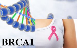 Почему нужно сдавать анализ BRCA1?