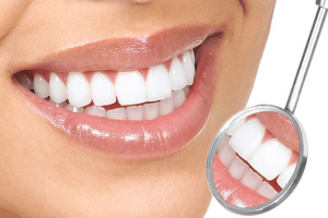 В чем преимущества профессиональной чистки зубов