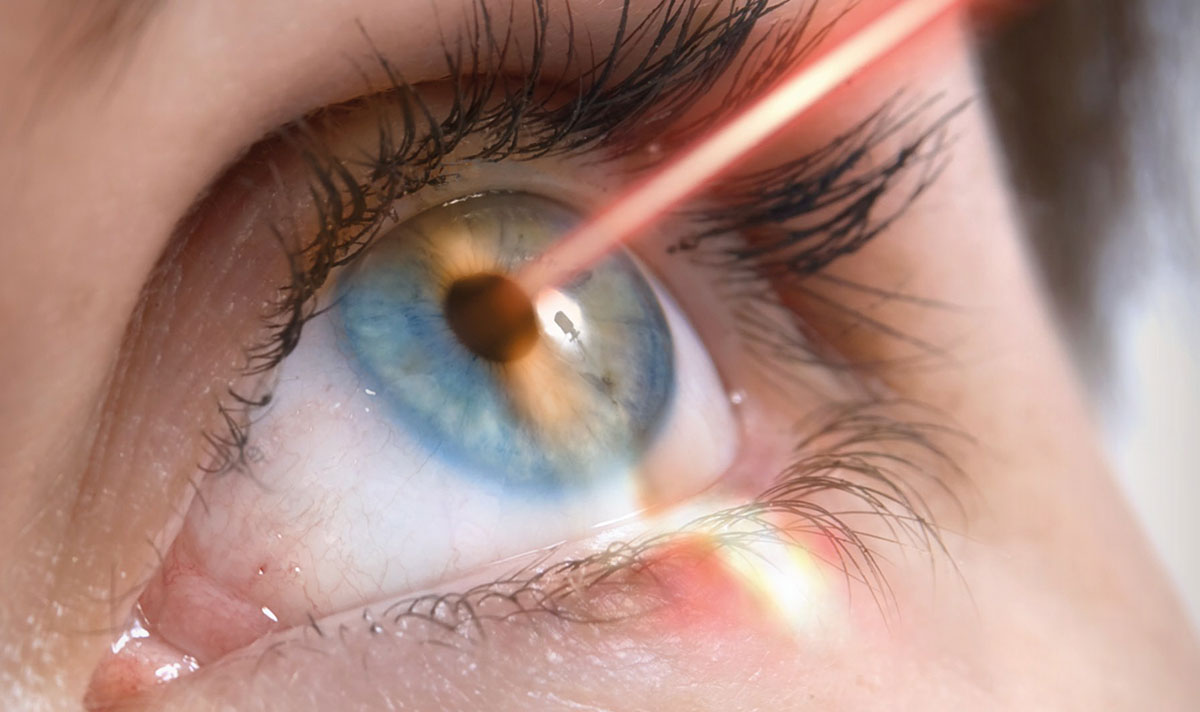 Глаз звуки. Лазерная операция на глаза. Офтальмология операции лазерная.