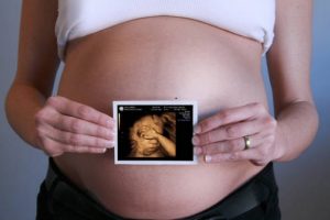 3D УЗИ – контроль протекания беременности