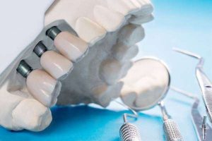 Современные технологии в стоматологии: инновации, которые меняют подход к лечению