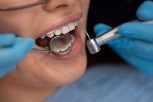 Реставрация зубов - передовые методы и современные технологии