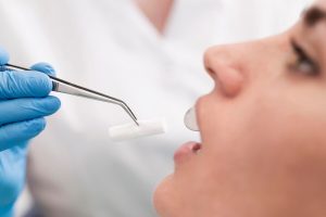 Основные показания к удалению зубов